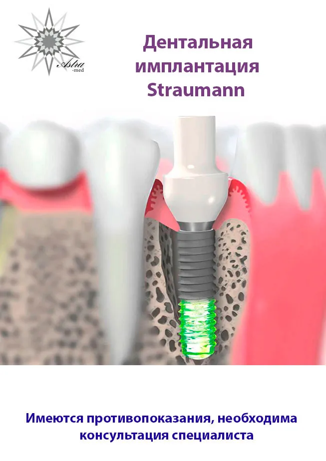 Дентальная имплантация Straumann