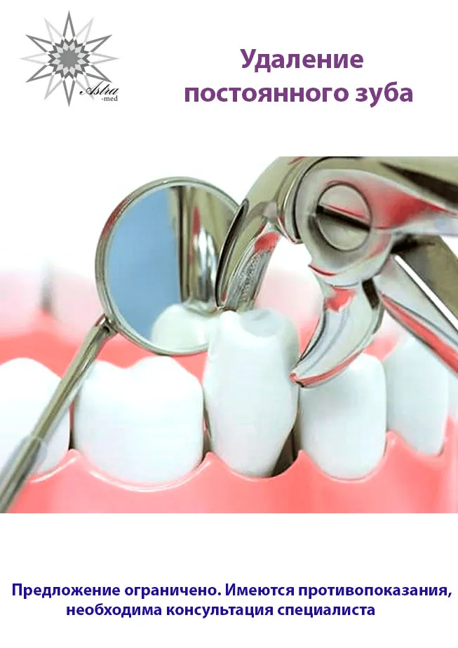Удаление зуба