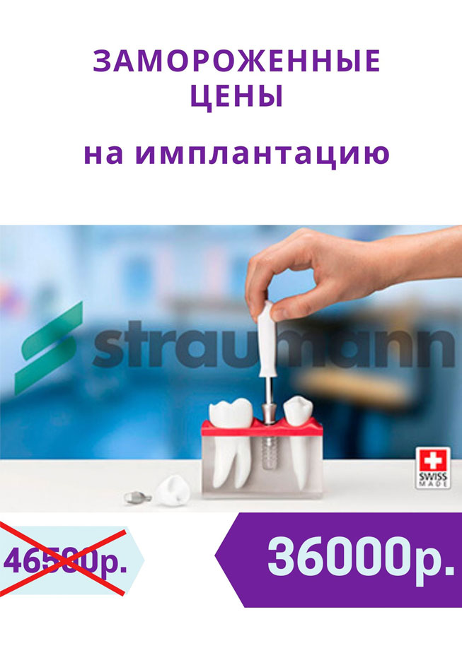 Заморожены цены на имплантацию