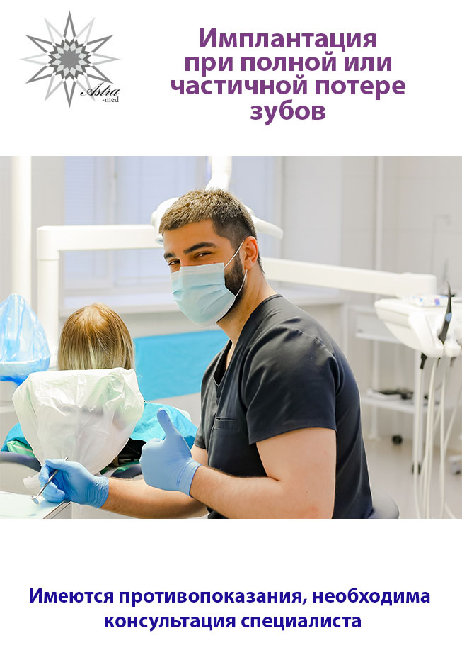Имплантация